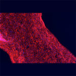 Human proximal tubule cells adhere to the hollow channel, forming a functional, 3D renal architecture. Credit: Lewis Lab/Wyss Institute at Harvard University