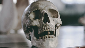 regrow bone skull hydrogels 