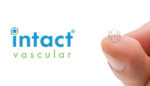 Intact Vascular finishes patient enrollment for angioplasty clinical trial
