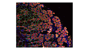 Regenerated muscle cells