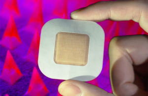adhesive microneedle coin-sized insulin patch UCLA diabetes
