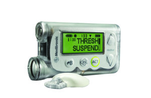 Medtronic 530G Enlite insulin pump