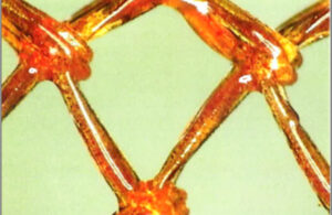 A close-up of orange polypropylene mesh coated with antibiotics