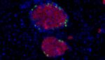 Stanford Medicine Diabetes insulin-secreting pancreatic islet cells mice