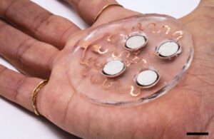 MIT Ultrasound Patch for drug delivery