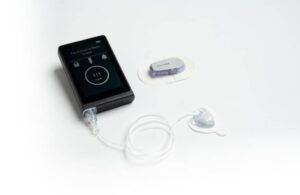 Beta Bionics iLet Dexcom G6 Convatec infusion set