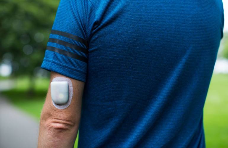 Insulet Omnipod 5 worn on the back of an arm