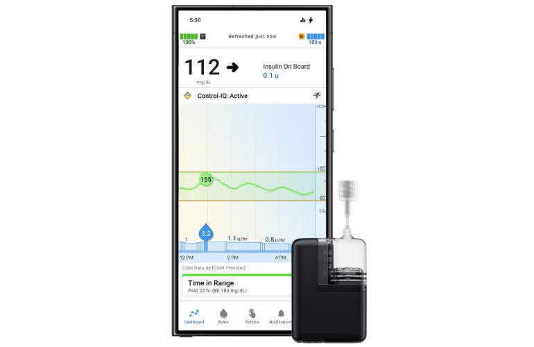 Tandem Mobi insulin pump with Android smartphone (1)