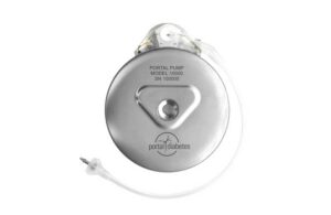 Portal Diabetes Portal Pump implantable insulin pump