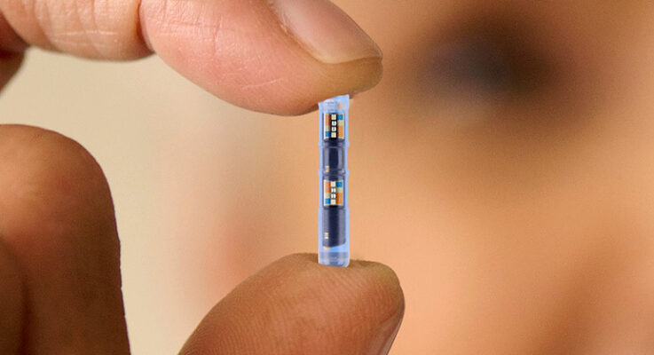 Sensonics launches human feasibility study for transmitter-free Eversense CGM